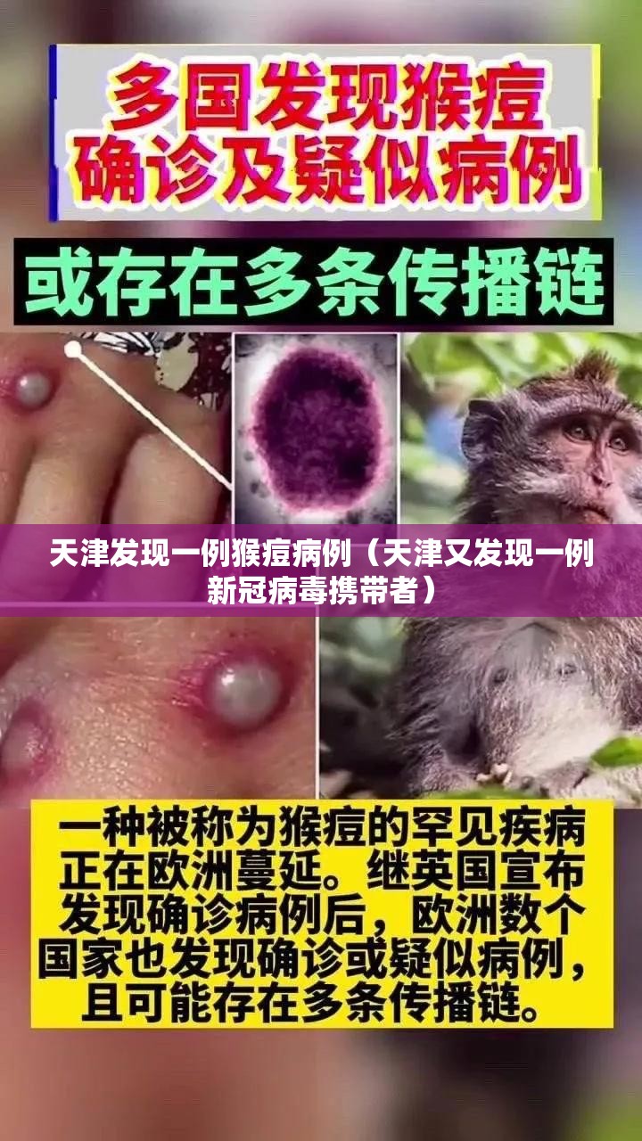 天津发现一例猴痘病例(天津又发现一例新冠病毒携带者) 天津发现一例猴痘病例(天津又发现一例新冠病毒携带者)