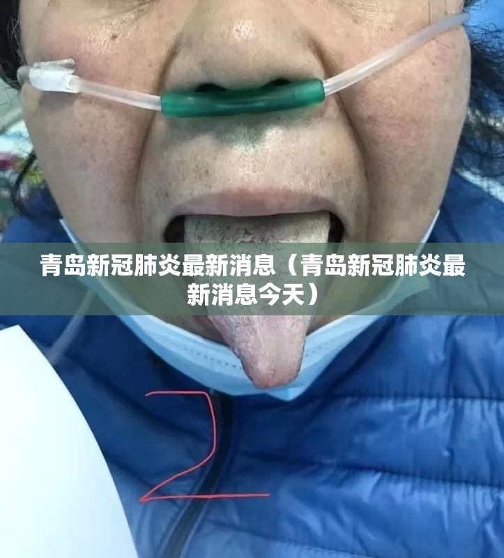 青岛新冠肺炎最新消息(青岛新冠肺炎最新消息今天) 青岛新冠肺炎最新消息(青岛新冠肺炎最新消息今天)