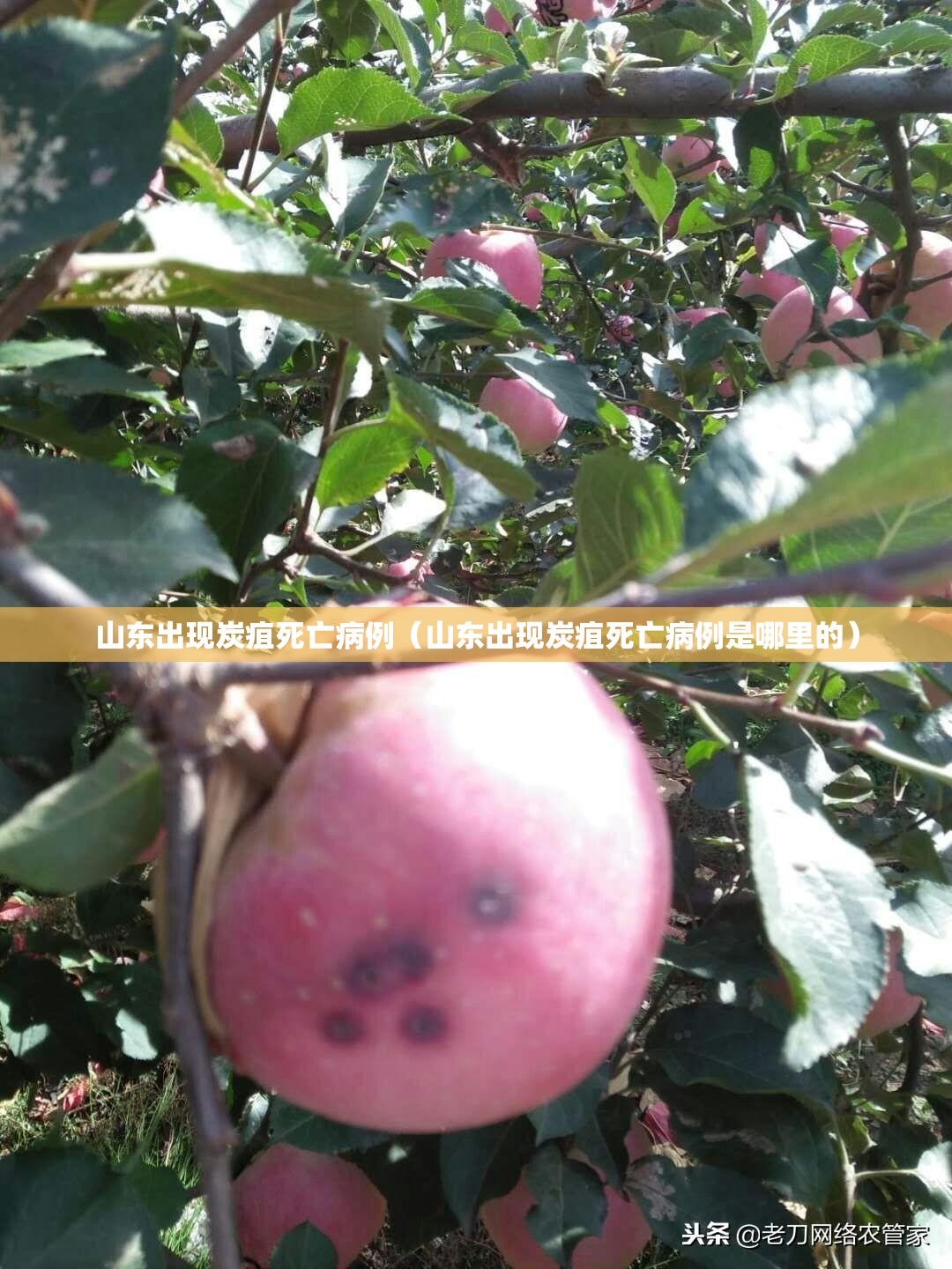 山东出现炭疽死亡病例（山东出现炭疽死亡病例是哪里的）