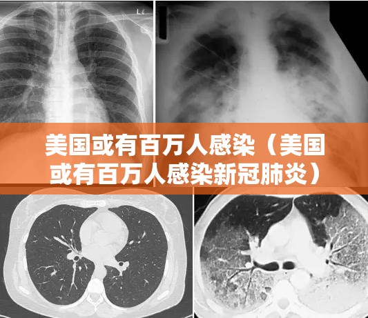 美国或有百万人感染(美国或有百万人感染新冠肺炎) 美国或有百万人感染(美国或有百万人感染新冠肺炎)
