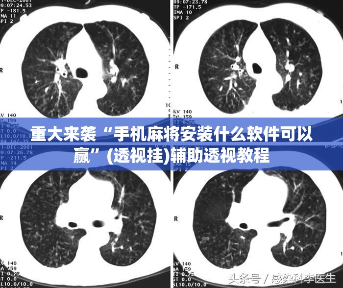 重大来袭“手机麻将安装什么软件可以赢”(透视挂)辅助透视教程 重大来袭“手机麻将安装什么软件可以赢”(透视挂)辅助透视教程