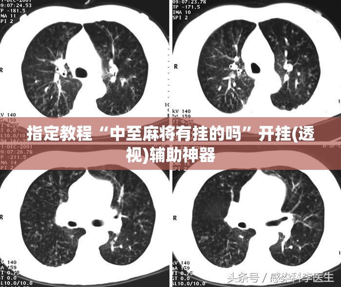 指定教程“中至麻将有挂的吗”开挂(透视)辅助神器
