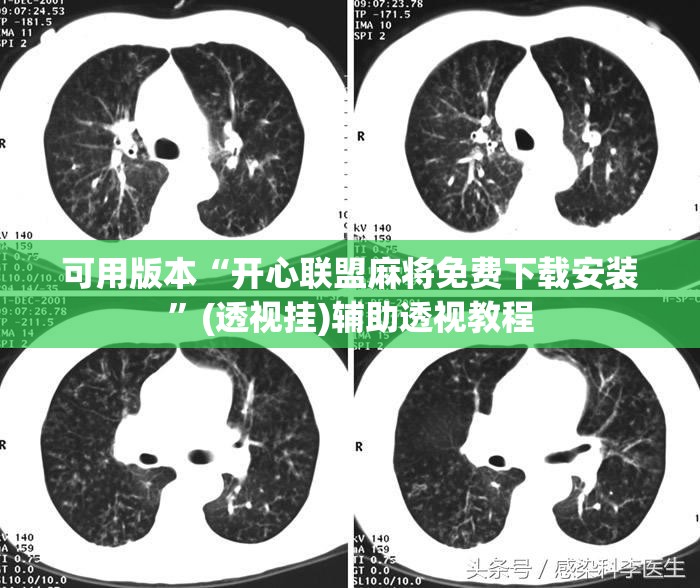 可用版本“开心联盟麻将免费下载安装”(透视挂)辅助透视教程