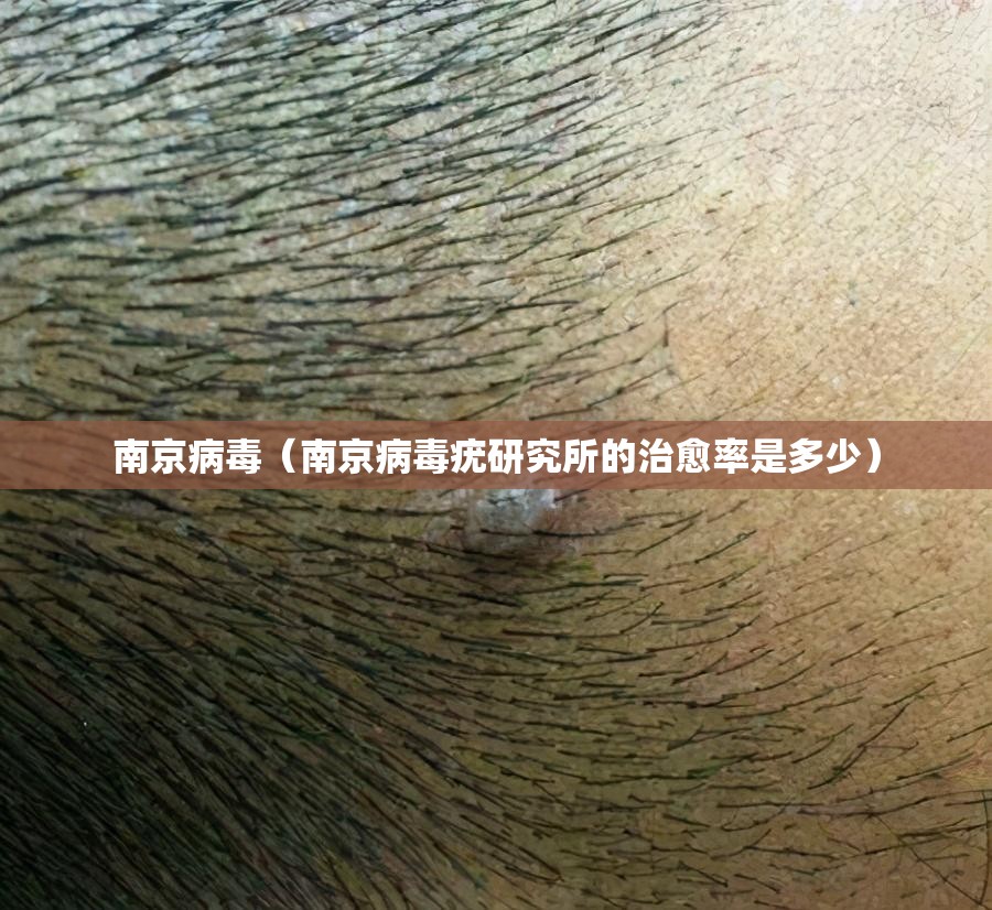 南京病毒(南京病毒疣研究所的治愈率是多少) 南京病毒(南京病毒疣研究所的治愈率是多少)