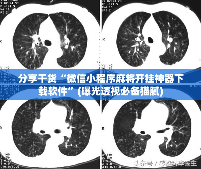 分享干货“微信小程序麻将开挂神器下载软件”(曝光透视必备猫腻) 分享干货“微信小程序麻将开挂神器下载软件”(曝光透视必备猫腻)