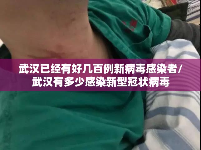 武汉已经有好几百例新病毒感染者/武汉有多少感染新型冠状病毒 武汉已经有好几百例新病毒感染者/武汉有多少感染新型冠状病毒