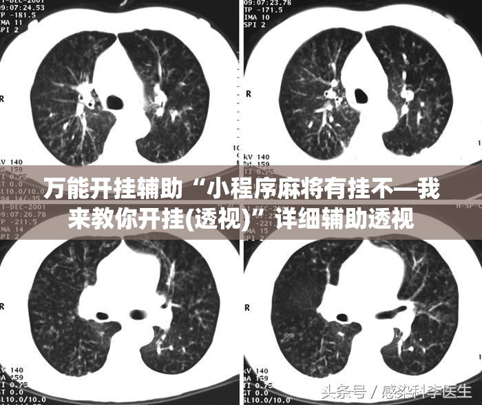 万能开挂辅助“小程序麻将有挂不—我来教你开挂(透视)”详细辅助透视 万能开挂辅助“小程序麻将有挂不—我来教你开挂(透视)”详细辅助透视