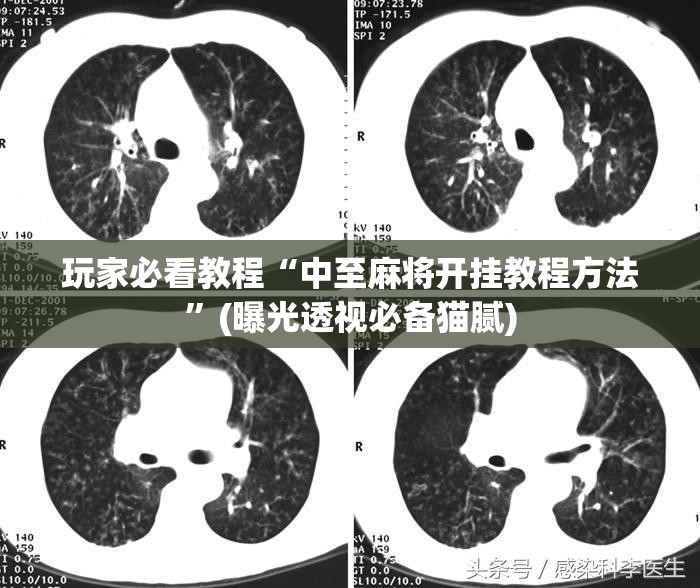 玩家必看教程“中至麻将开挂教程方法”(曝光透视必备猫腻)