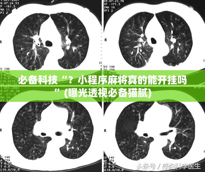 必备科技“？小程序麻将真的能开挂吗”(曝光透视必备猫腻)
