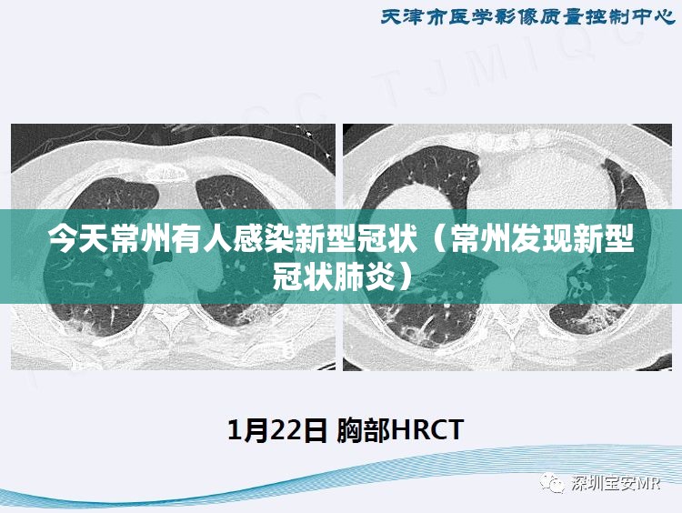 今天常州有人感染新型冠状（常州发现新型冠状肺炎）