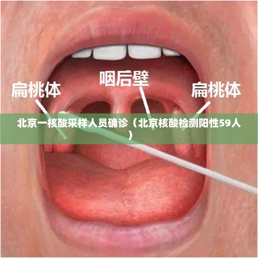 北京一核酸采样人员确诊（北京核酸检测阳性59人）