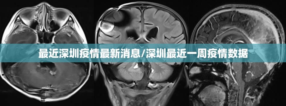 最近深圳疫情最新消息/深圳最近一周疫情数据
