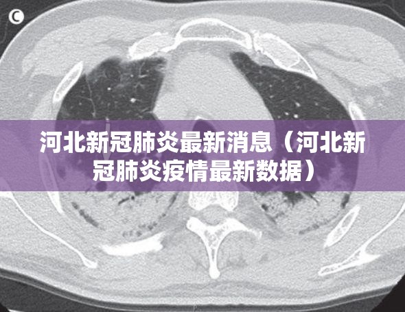 河北新冠肺炎最新消息（河北新冠肺炎疫情最新数据）