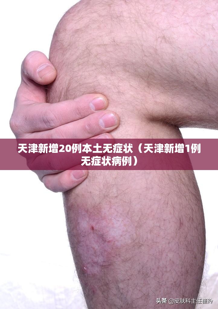天津新增20例本土无症状(天津新增1例无症状病例) 天津新增20例本土无症状(天津新增1例无症状病例)