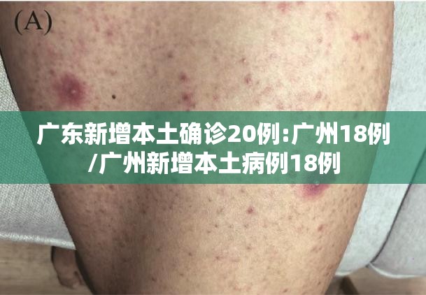 广东新增本土确诊20例:广州18例/广州新增本土病例18例 广东新增本土确诊20例:广州18例/广州新增本土病例18例